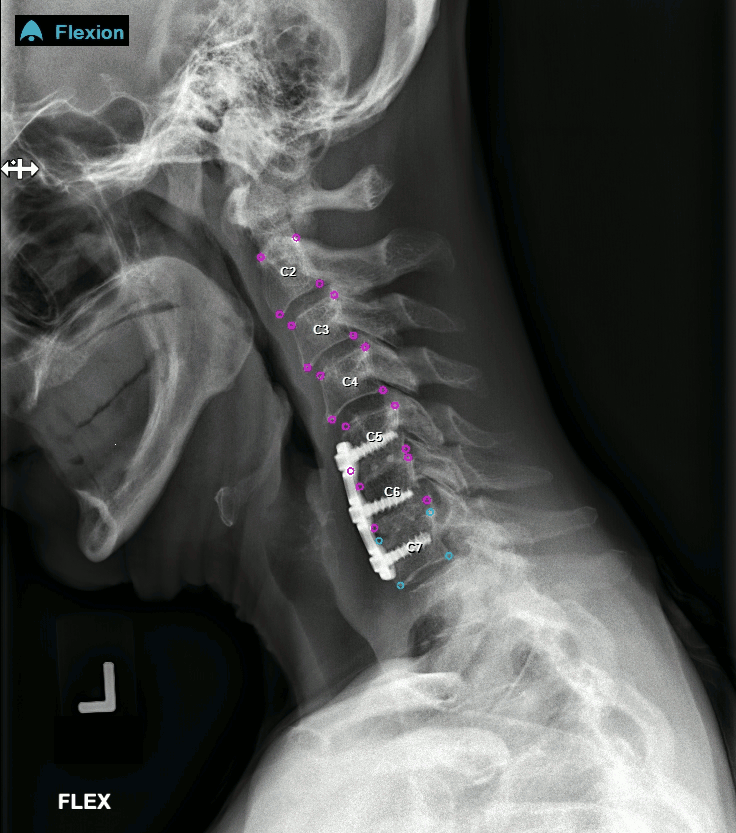 ai radiology banner pic